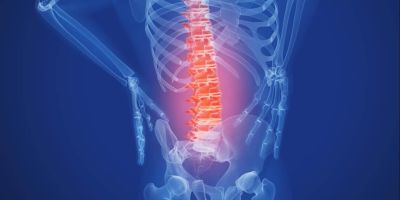 Pilates para el dolor de espalda en Santander